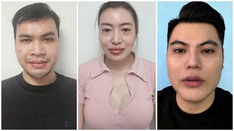 tctd-khong-co-bang-y-hoc-trung-cap-thu-y-cung-dong-vai-bac-si-chua-benh-cho-nguoi-1761554079.jpg